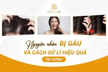 Nguyên Nhân Và Cách Xử Lý Gàu Một Cách Triệt Để